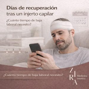 dias recuperación tras un injerto capilar