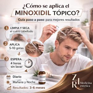 como se aplica minoxidil tópico en el pelo