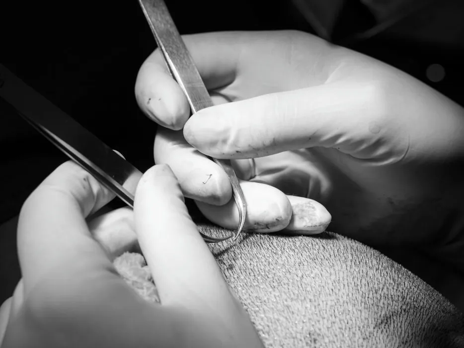 Trabajo por tandas en quirófano